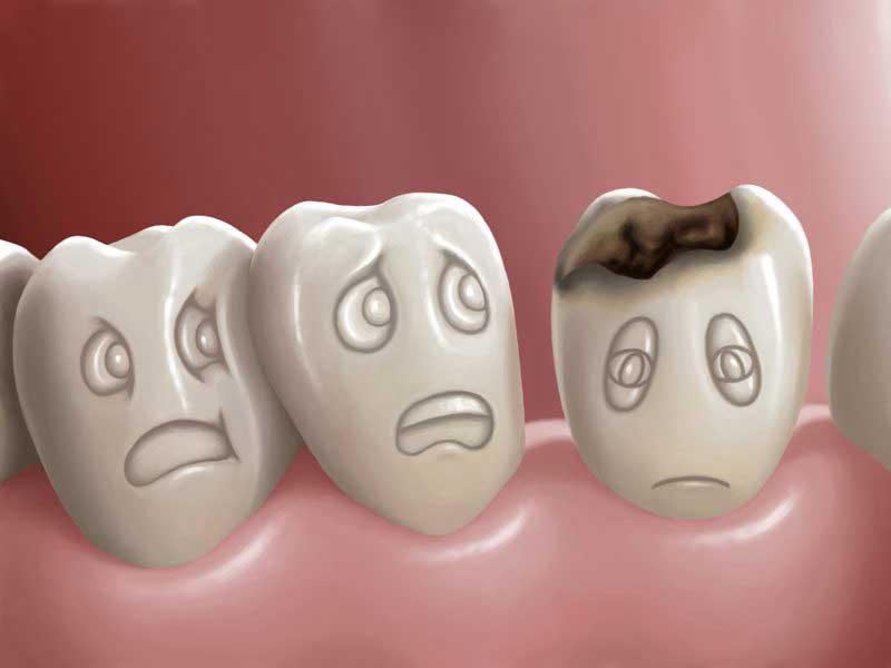 عوارض حفره دندان